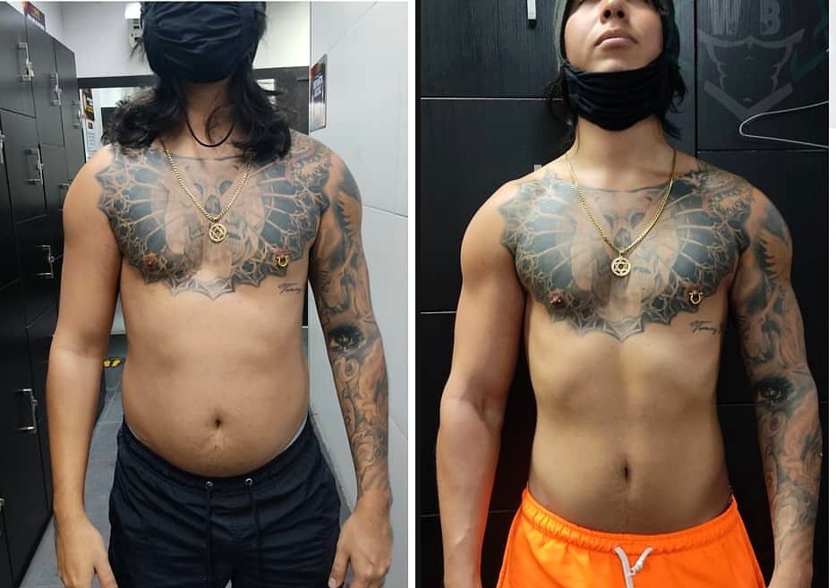 Before / After — Front
